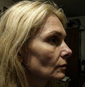 Dr. Lilla A.