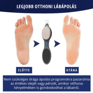 4 az 1-ben pedikűreszköz – SoftFeet - Image 4
